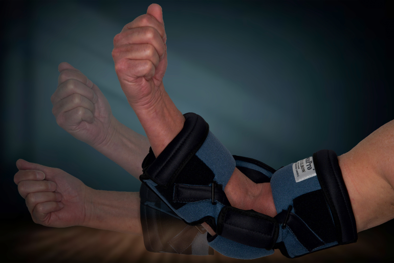 dp elbow flexing